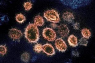 Studi: Orang Pernah Terpapar COVID-19 Mungkin Terlindung dari Infeksi Ulang