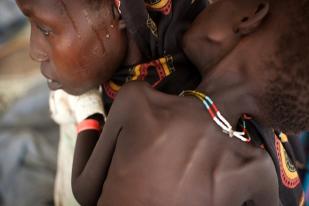 Tingkat Kelaparan di Sudan Selatan Mengkhawatirkan