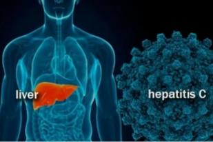 IDI-IDAI Imbau Masyarakat Waspadai KLB Hepatitis Akut