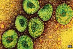 Lima Warga Arab Saudi Meningal Akibat Virus Mirip SARS