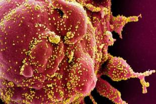 WHO Menepis Virus Corona Menyebar Lewat Kemasan Makanan