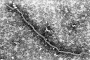 Virus Nipah: 600 Kasus dalam 17 Tahun, COVID-19: 100 Juta dalam Setahun