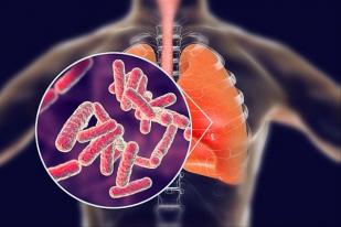 TBC Masih Jadi Ancaman Masyarakat, Kemekes Lakukan Tes Tuberkulin