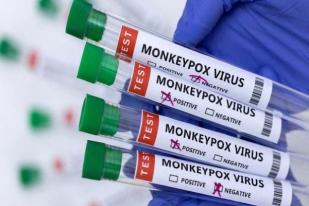 Peneliti: Virus Cacar Monyet Terus Bermutasi