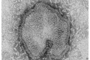 WHO: Virus Flu Burung H7N9 Paling Berbahaya
