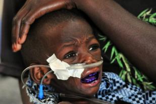 UNICEF Cek Kesehatan Penderita Gizi Buruk di Malawi