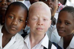 PBB Kecam Lonjakan Penyerangan terhadap Warga Albino