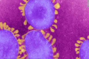 8 Kasus Terbaru Virus Corona Mers, 102 Orang Terjangkit, 49 Tewas