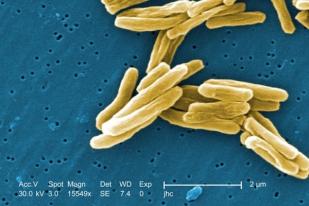 17,1 Juta Penduduk Dunia Terkena Tuberkulosis 