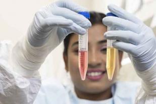 Tes Baru Temukan HIV yang Tersembunyi