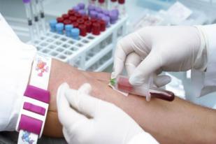 Tes Darah untuk Deteksi Dini Delapan Jenis Kanker