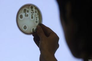 Ilmuwan Kembangkan Alat yang Deteksi Bakteri dalam Hitungan Hari