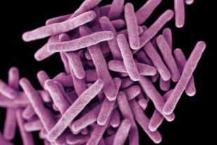 WHO: Penderita TBC di Indonesia Masih Tinggi 