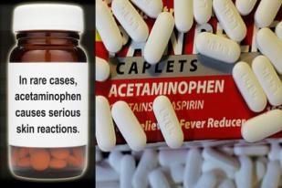 FDA: Peringatkan Risiko Acetaminophen, Meskipun Jarang Tapi Sangat Berbahaya