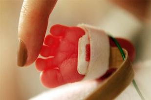 Dampak Jangka Panjang Bayi Lahir Prematur