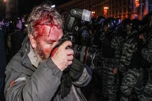 Pulahan Wartawan Terluka dalam Kerusuhan di Ukraina