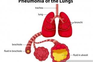 KBRI Beijing Keluarkan Imbauan Terkait Pneumonia Berat