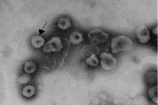 Wabah Virus Corona Menyebar di China