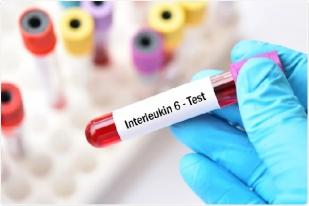 Interleukin-6 Obat Baru Rekomendasi WHO untuk Pasien COVID-19