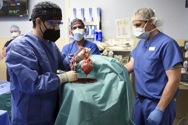 Pertama Dilakukan Transplantasi Jantung Babi ke Manusia