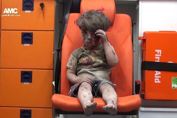 Bocah Ini Jadi Simbol Penderitaan Suriah