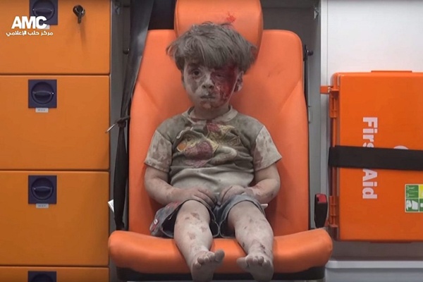 Bocah Ini Jadi Simbol Penderitaan Suriah