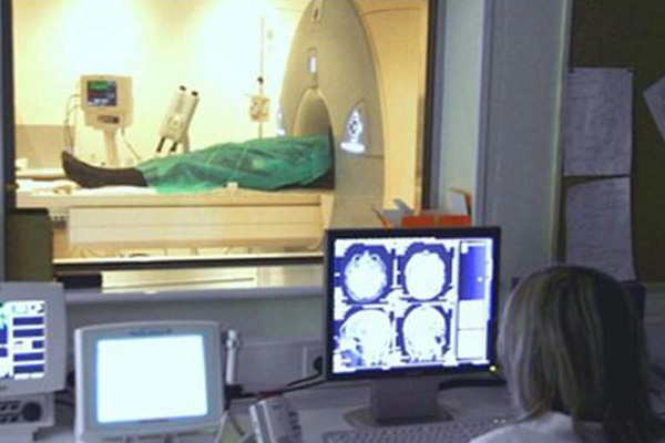 Deteksi Alzheimer Sejak Dini dengan MRI