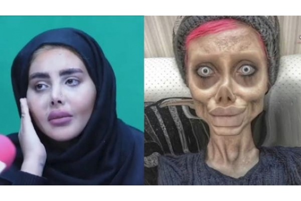 “Angelina Jolie Zombie” Iran Dibebaskan dengan Jaminan - Satu Harapan